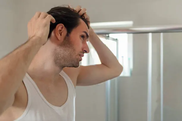 white man looking at psoriasis on head in mirror